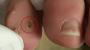 Le Mag de la santé - Émission du mercredi 15 avril 2026