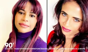 90' Enquêtes - Folies esthétiques et opérations risquées : enquête sur le nouveau business de la beauté